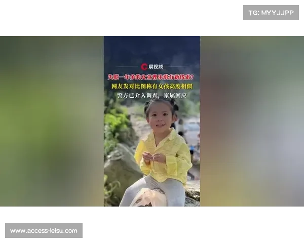 高菁遥骨折康复过程公开 网友称其为坚强钢铁女孩展现不屈精神